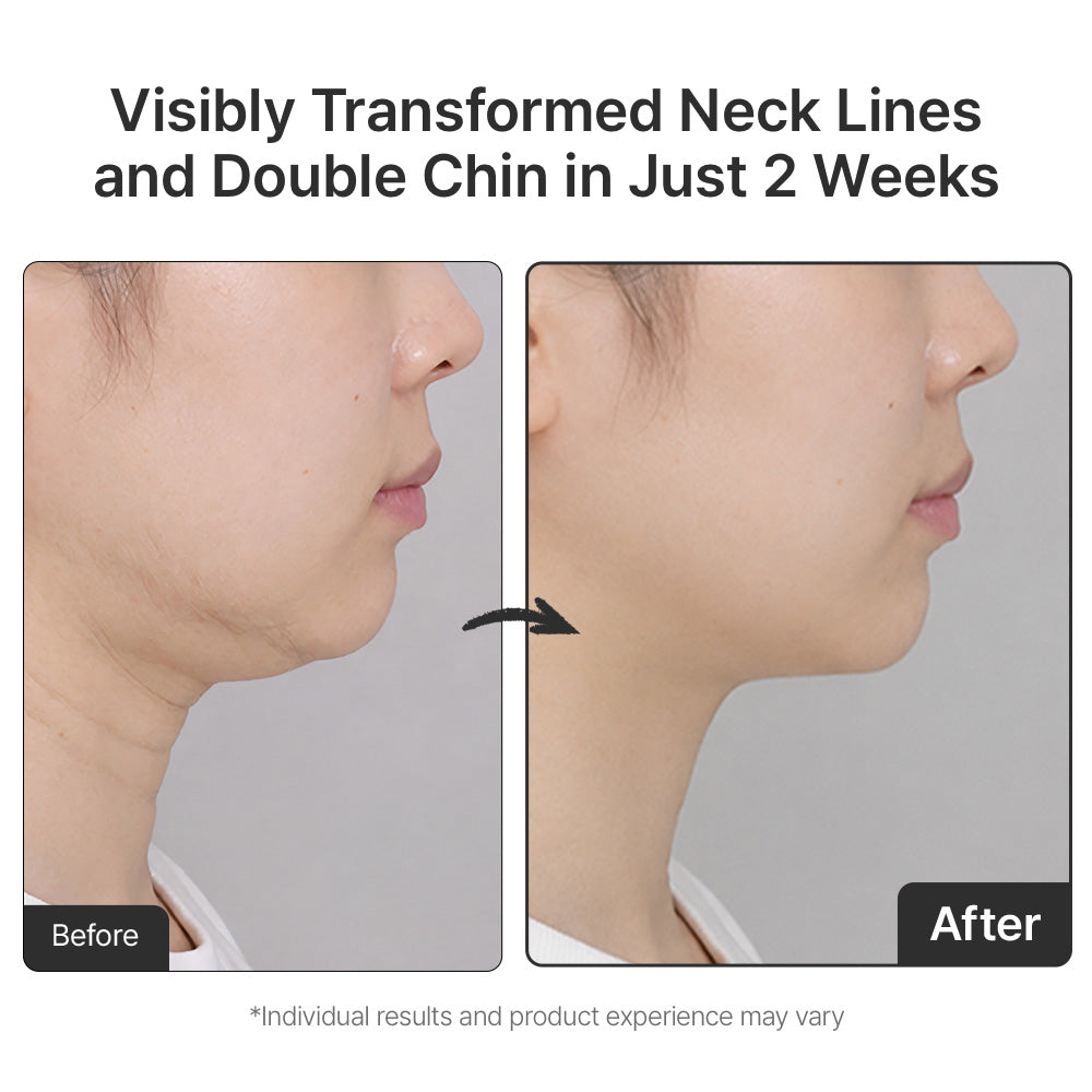 [Amazon #1] NAD+ Peptide Firming Serum