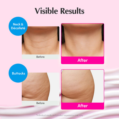 [EXCLUSIVE] Smooth & Firming Boost Set