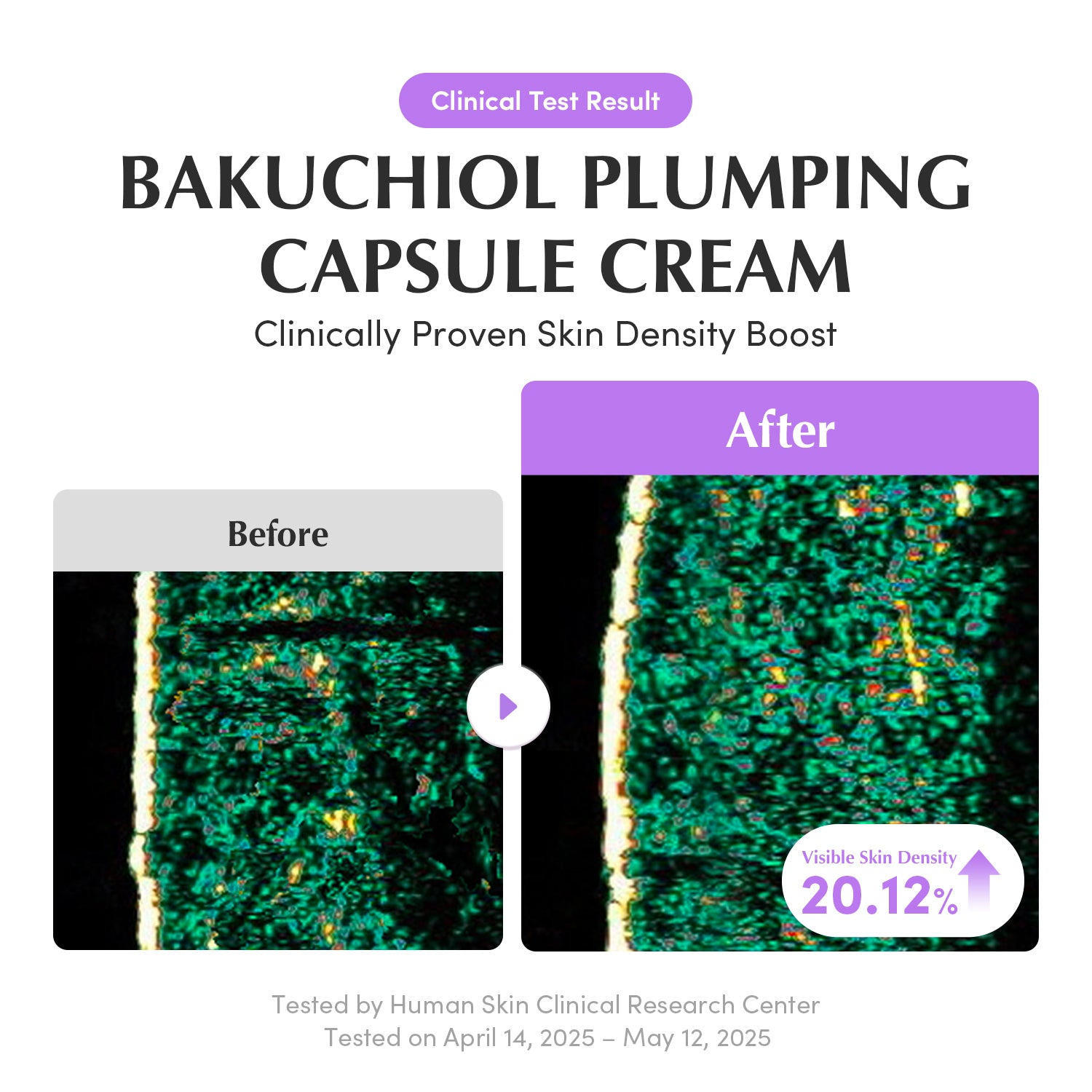 Amazon] Bakuchiol Plumping Capsule Cream – EQQUALBERRY
