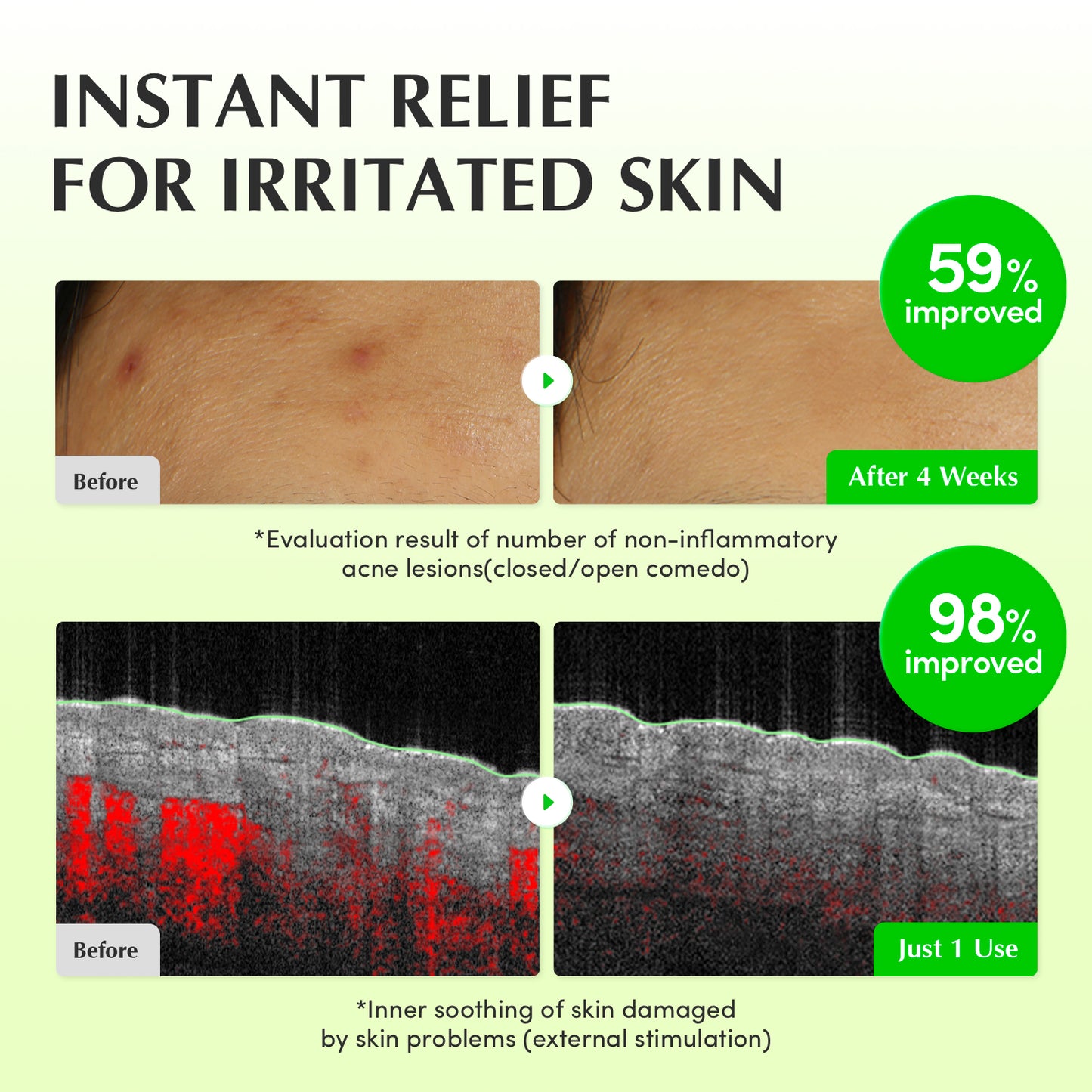 Aloe PDRN Calming Trio (Toner + Serum + Cream)