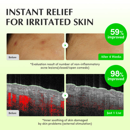 Aloe PDRN Calming Trio (Toner + Serum + Cream)