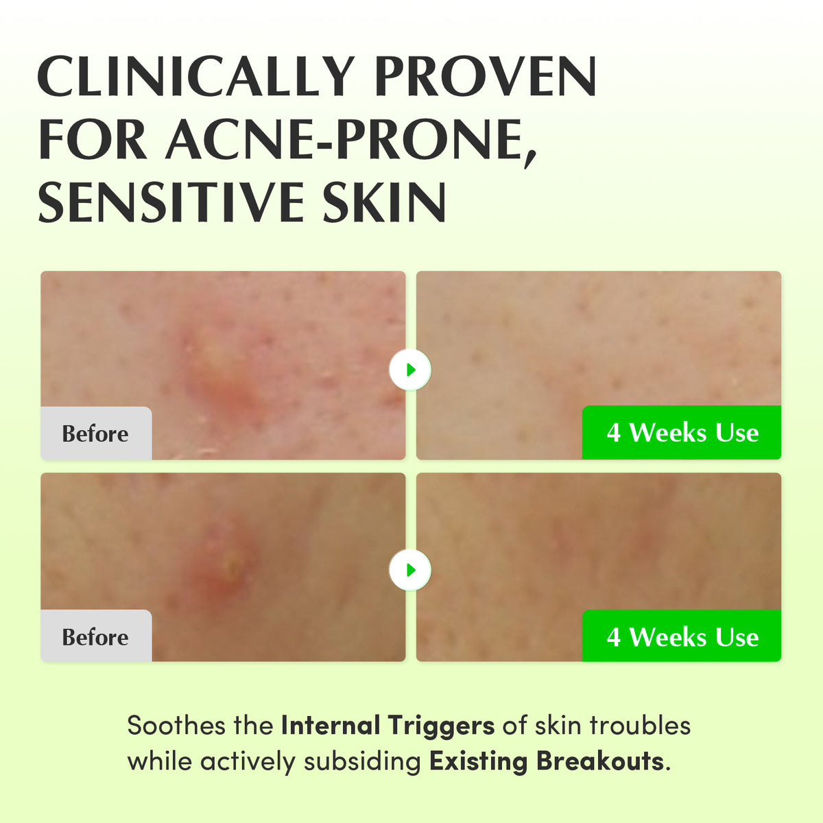 Aloe PDRN Calming Toner