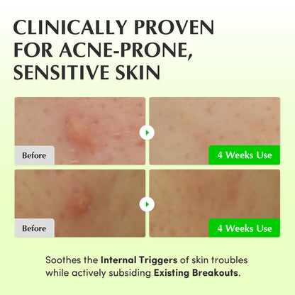 Aloe PDRN Calming Toner