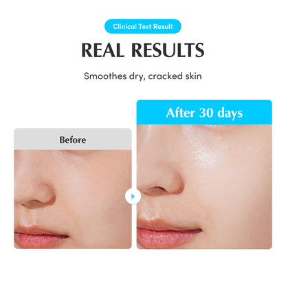 [EXCLUSIVE] Swimming Pool Texture Reset Set