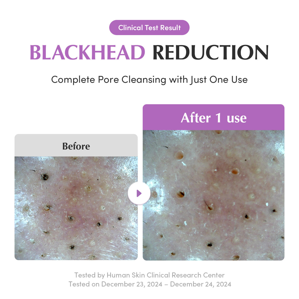Purple Rice Pore Purifying Pack Cleanser