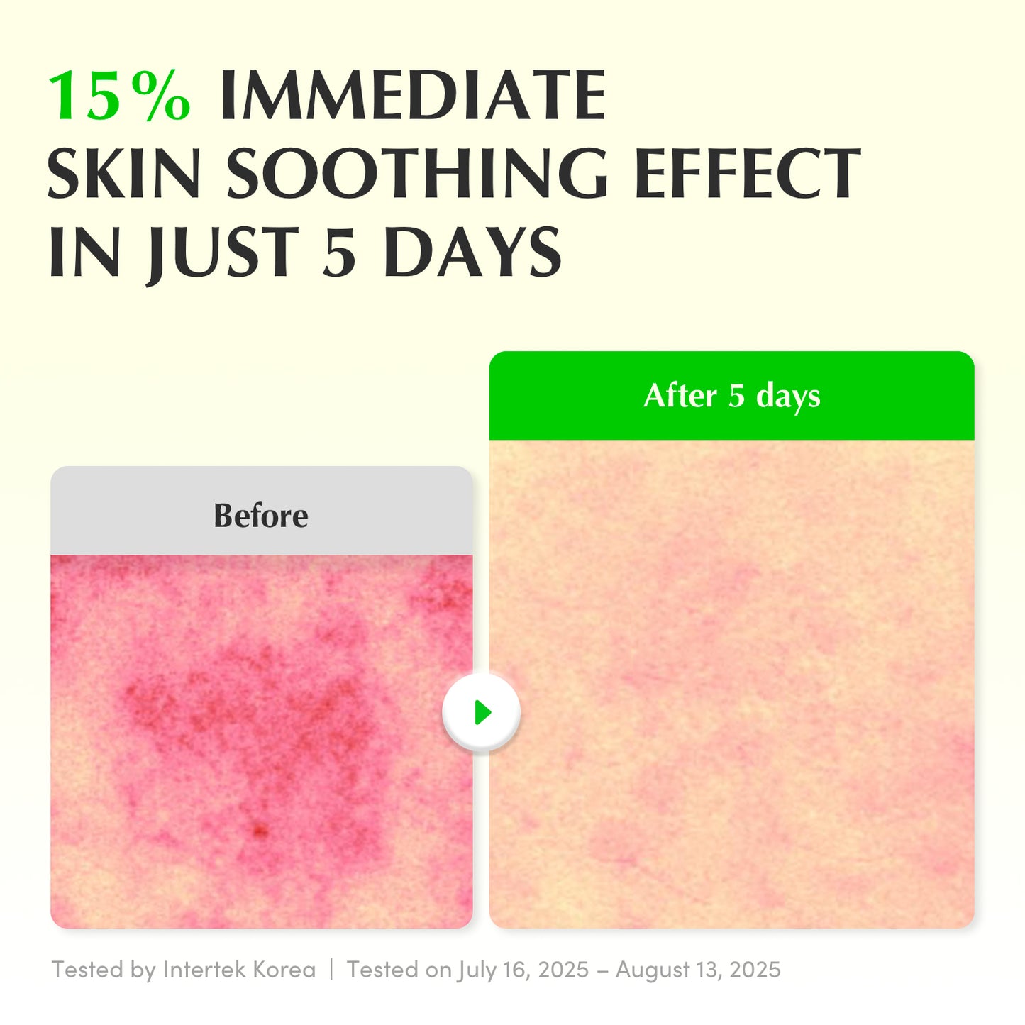 [EXCLUSIVE] Glow & Soothing Duo