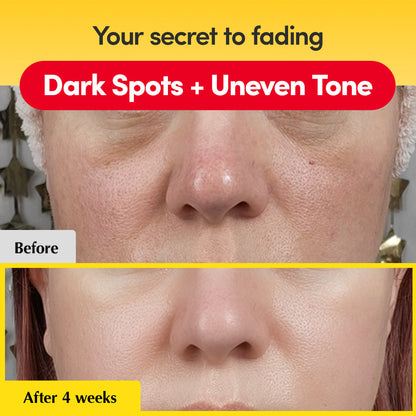 Equalberry Vitamin C Serum for dark spots and brightening