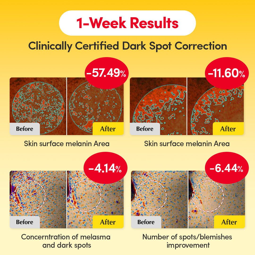 Equalberry Vitamin C Serum for dark spots and brightening