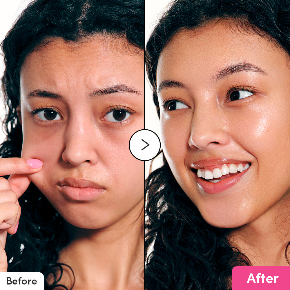 [Amazon] NAD+ Peptide Boosting Serum