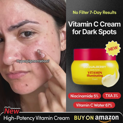 [Amazon's Choice] Vitamin Illuminating Dark Spots Cream✨