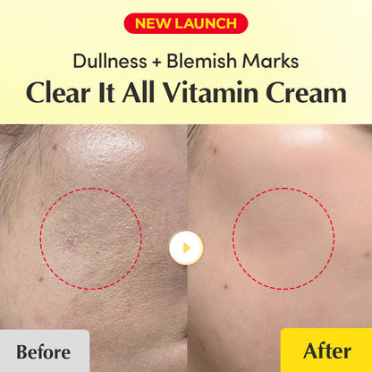 Equalberry Vitamin Cream for dark spots and brightening