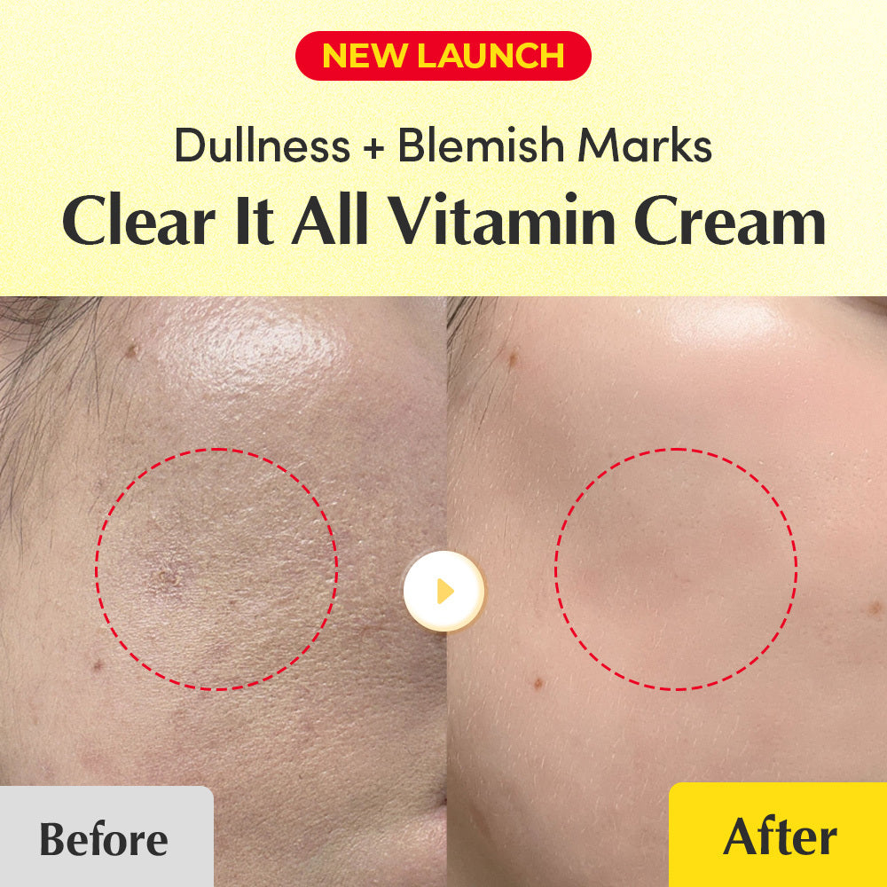 Equalberry Vitamin Cream for dark spots and brightening