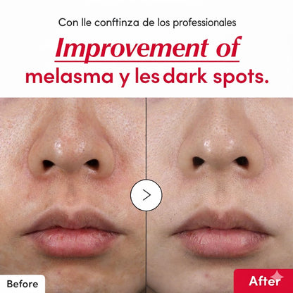 [Amazon] Vitamin illuminating Serum